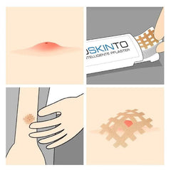 Moskinto The Intelligent Patch 24s | The Nest Attachment Parenting Hub